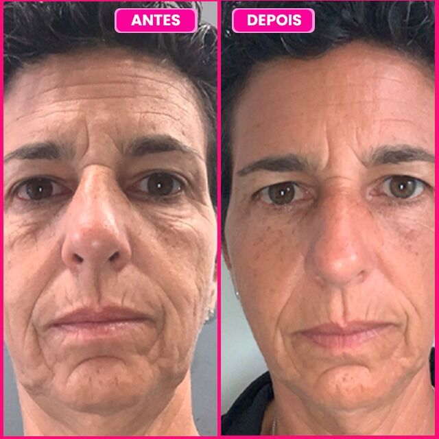 Depoimento 3