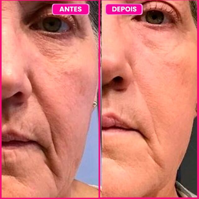 Depoimento 4