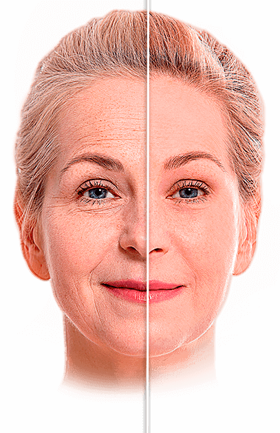 Modelo antes e depois